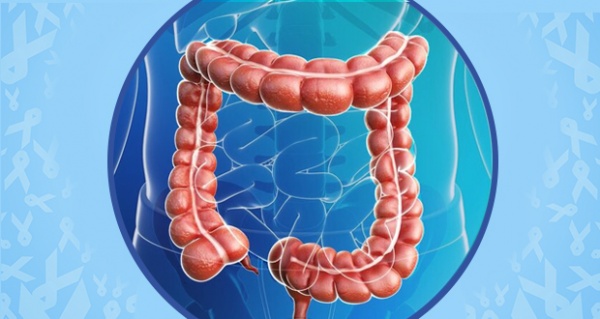 Colon Cancer Rates On The Rise Especially For Young Adults