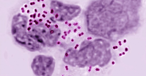 A Untreatable Strain Of Gonorrhea Has Been Discovered