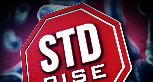 New Data Confirms STDs Continue Rapid Rise In The US